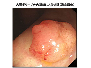 症例2