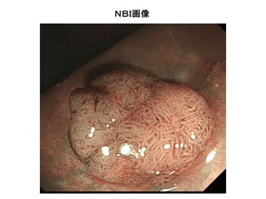 症例3