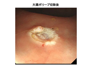 症例4